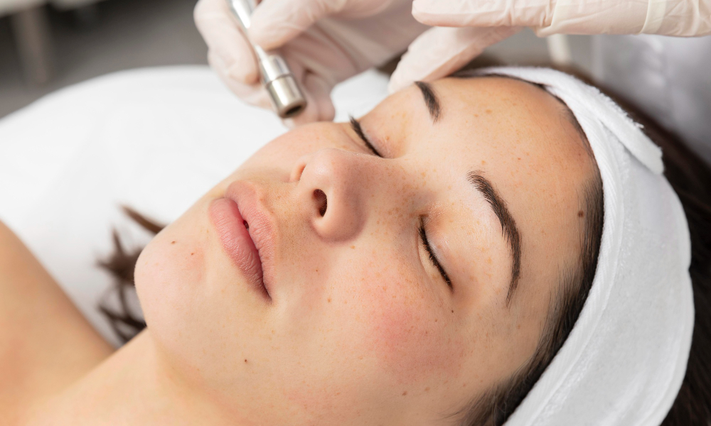 Microneedle Facials | San Antonio, TX | Believe Aesthetics