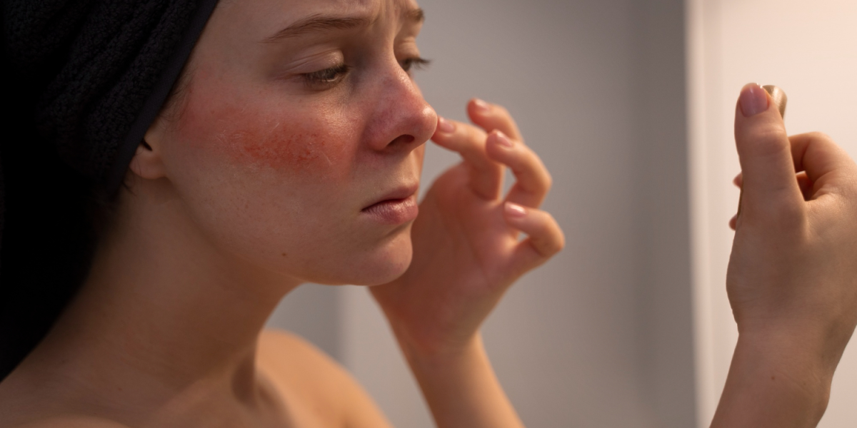 IPL-Treatment | San Antonio, TX | Believe Aesthetics