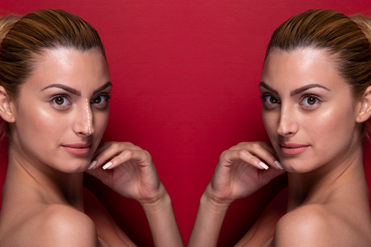 Botox vs Dysport vs Xeomin comparison chart for wrinkle treatment