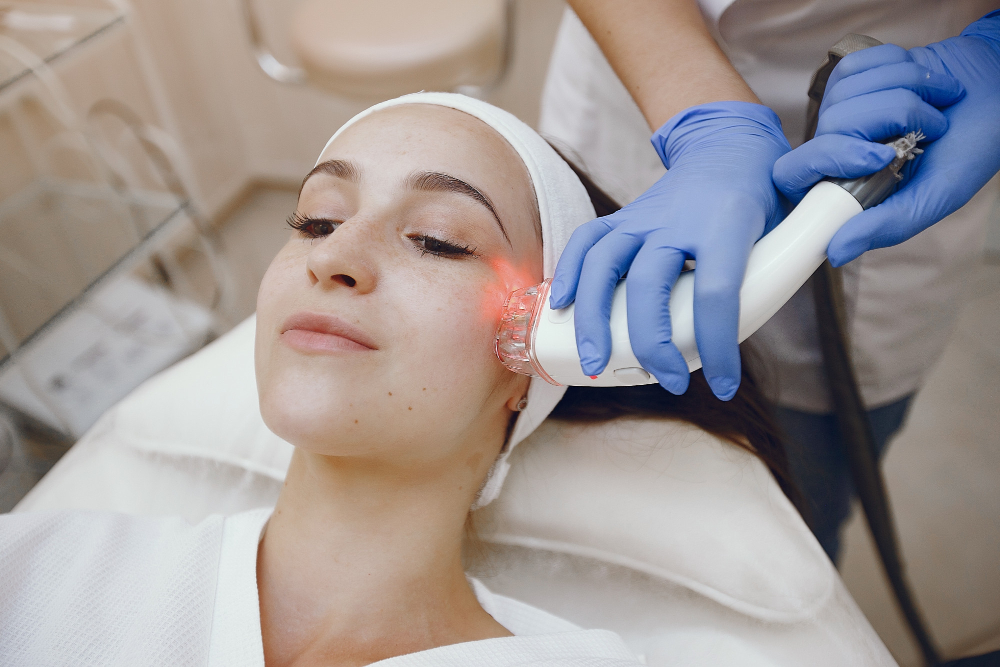 CoolPeel for Uneven Skin Tone- CO2 laser treatment