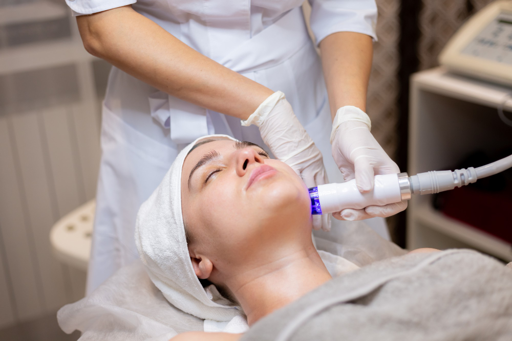CoolPeel for Acne Scars Services In San Antonio Texas