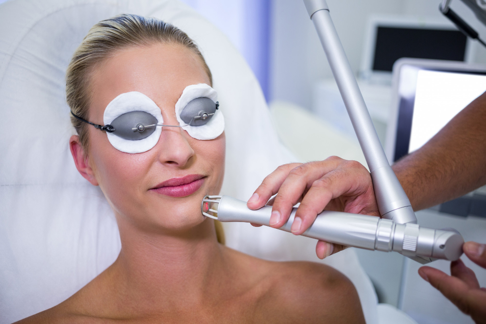 Understanding CoolPeel Downtime-A Modern Approach to Skin Resurfacing